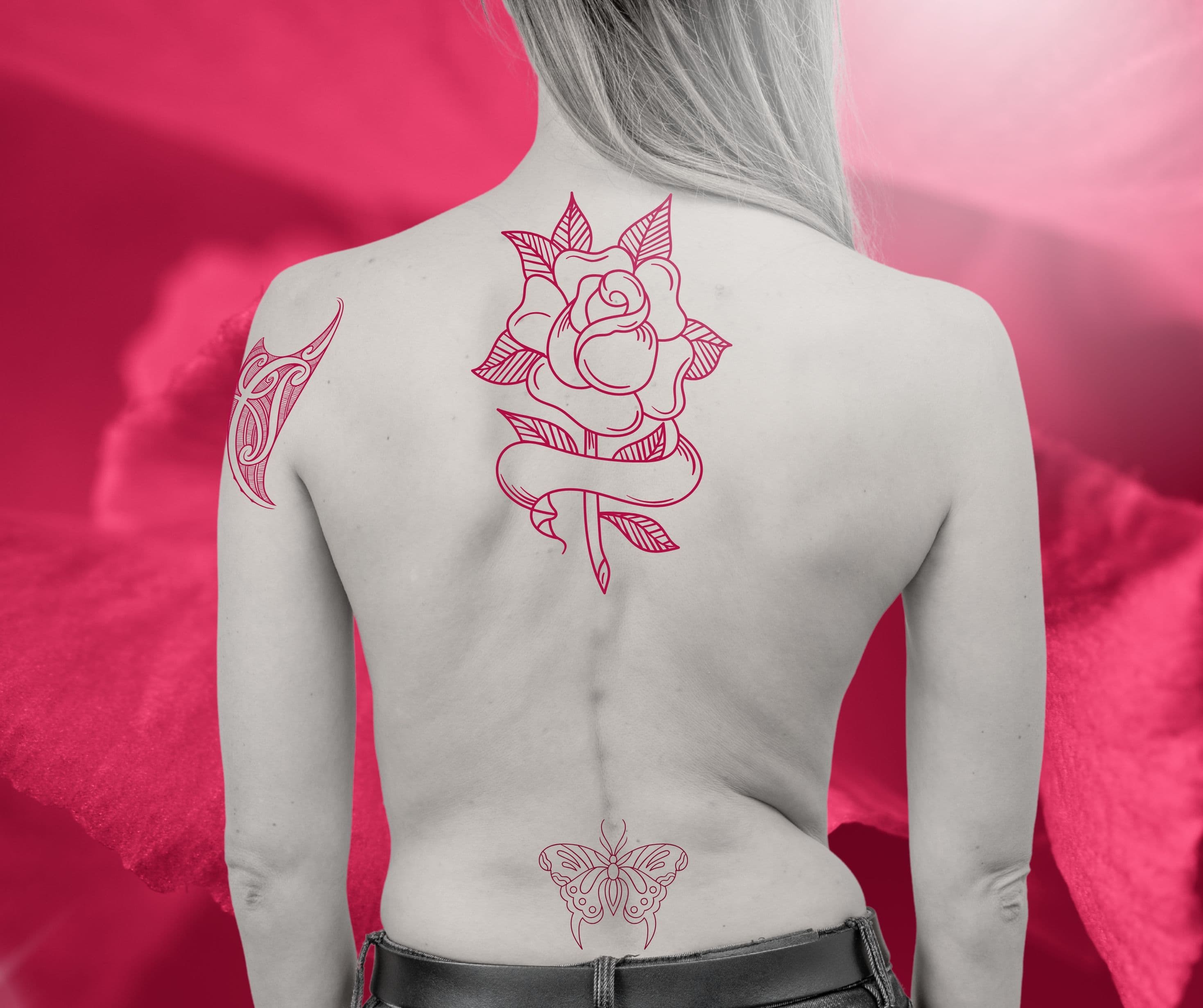 Clinic Service Tatoo Removal