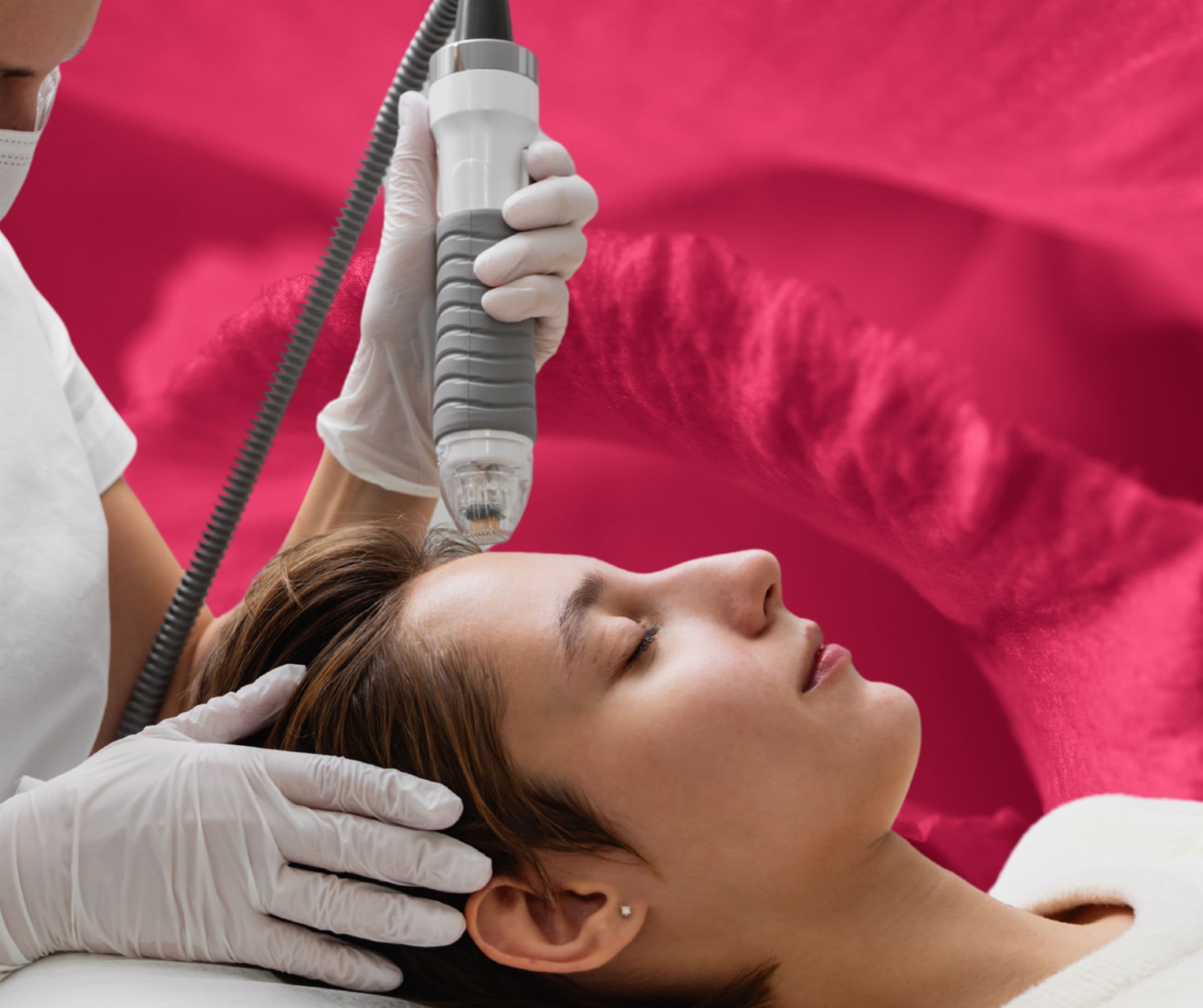 Clinic Service Microneedling RF