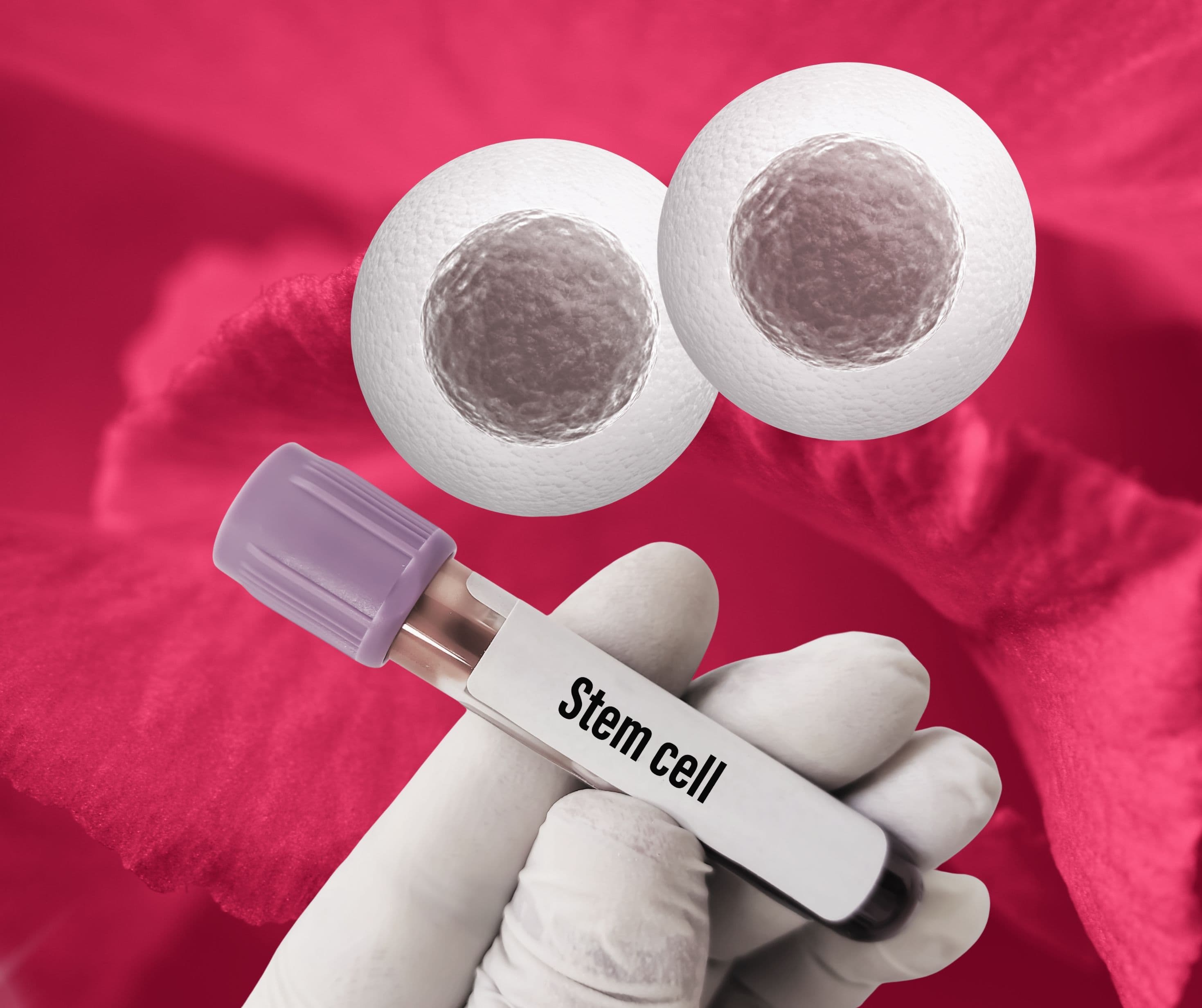 Clinic Service Stem Cell Therapy