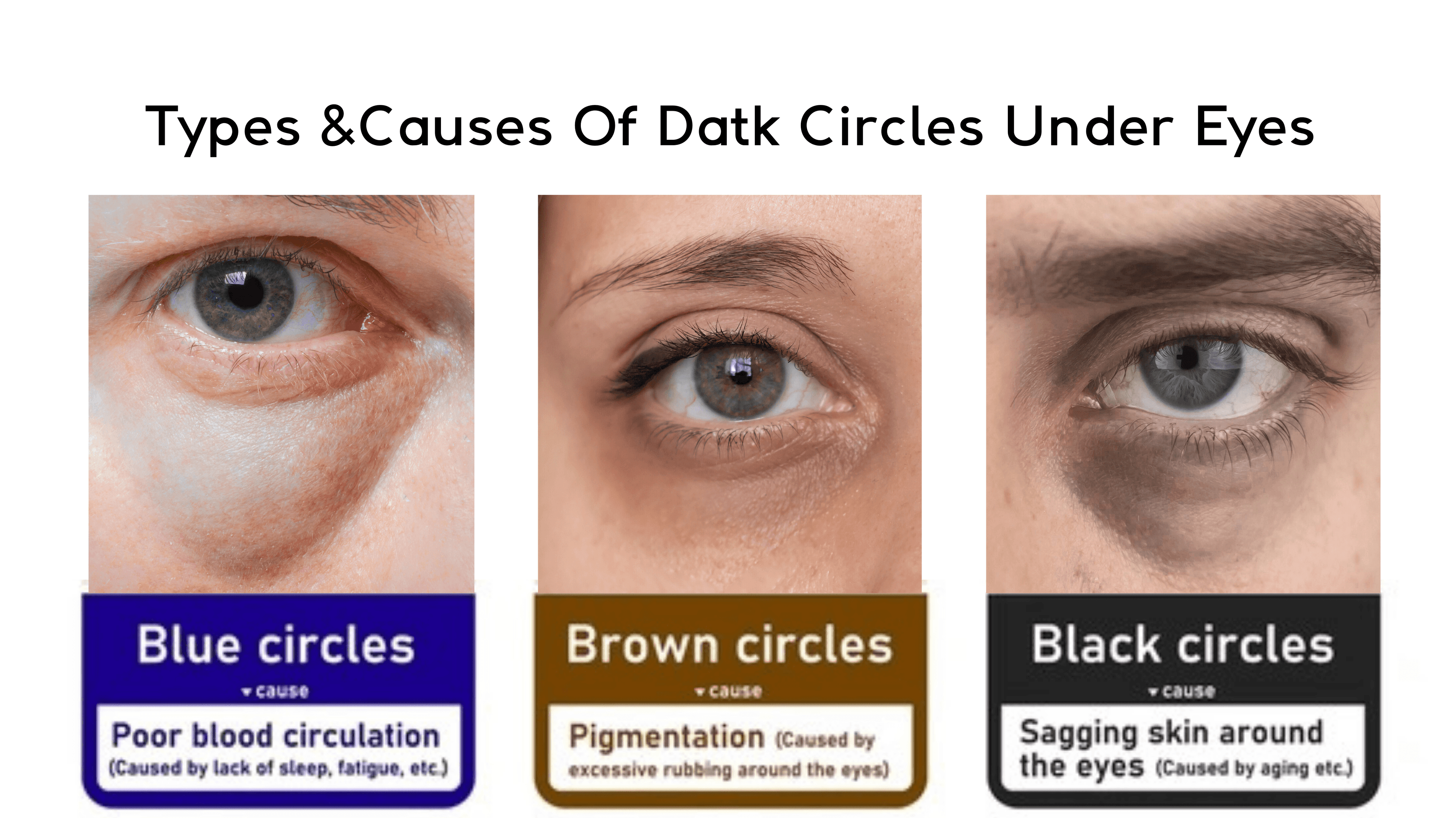 What Is the Best Dark Circle Treatment in Magenta Clinique?